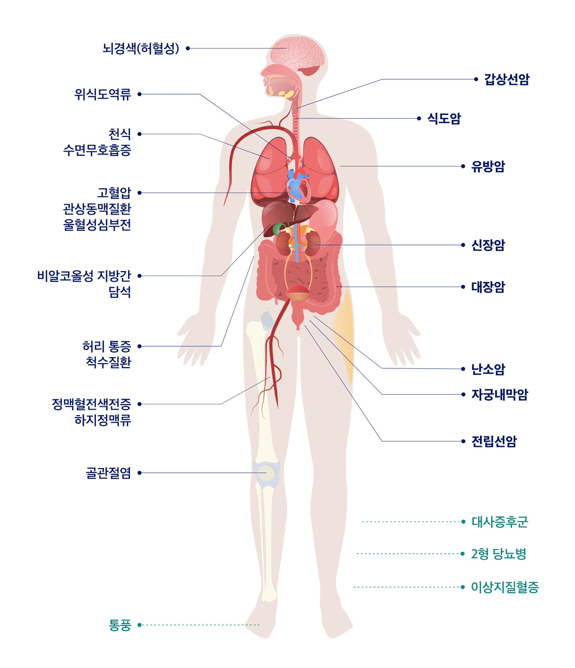 Obesity Related Risks